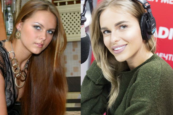 Модель Ханна Анна Иванова до и после пластических операций фото
