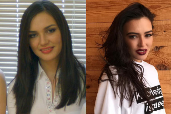 Ольга Серябкина до и после пластики фото