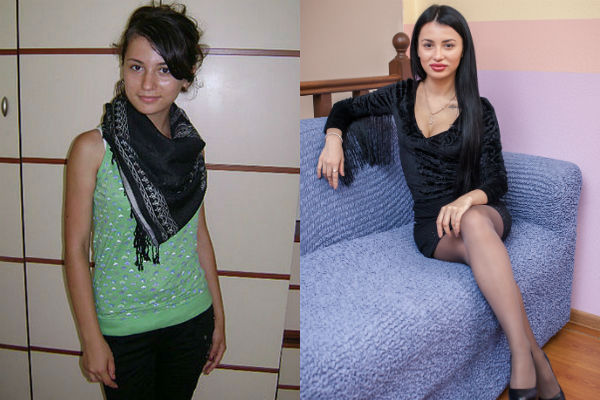 Лилия Четрару до и после пластики фото