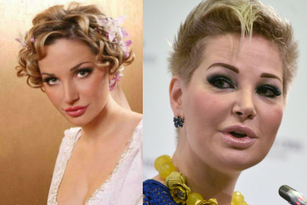 Мария Максакова до и после пластических операций фото