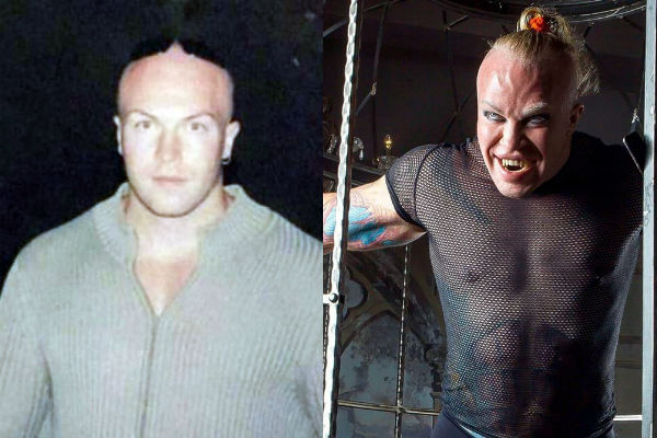 Блогер Александр Шпак до и после пластических операций на лице и теле фото