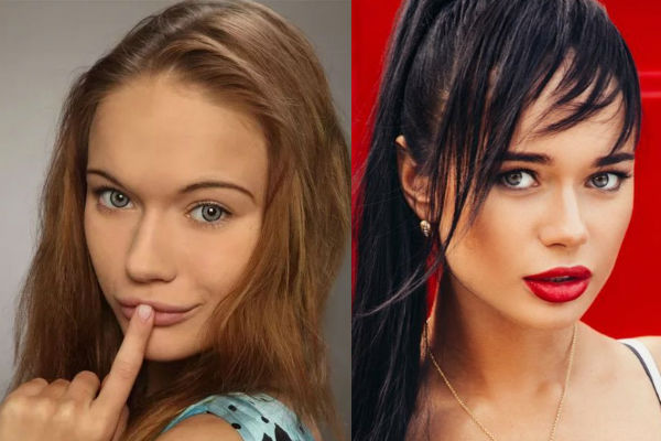 Пластические операции актрисы Яны Кошкиной до и после фото