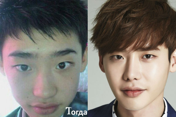 Корейский актер и модель Ли Чон Сок до и после пластики фото