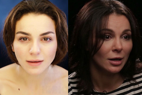 Внешность актрисы Лауры Кеосаян после пластики лица фото
