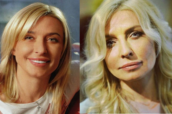Певица Татьяна Овсиенко до и после пластики фото