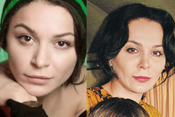 Лаура Кеосаян после антивозрастной пластики лица фото