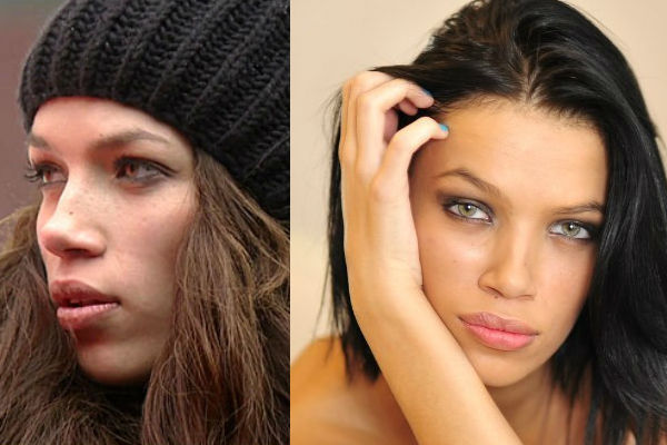Участница "Дом-2" Инесса Шевчук до и после пластических операций на лице фото