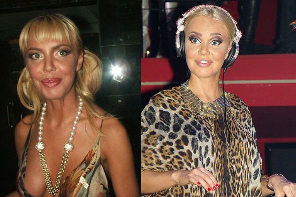 Телеведущая Маша Малиновская до и после пластики лица и тела фото