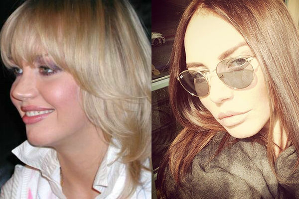Маша Малиновская до и после пластики фото