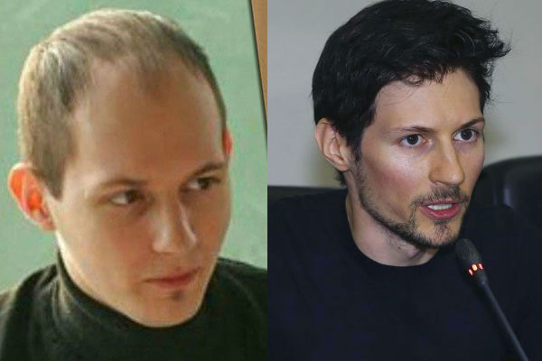 Павел Дуров после пластических операций фото