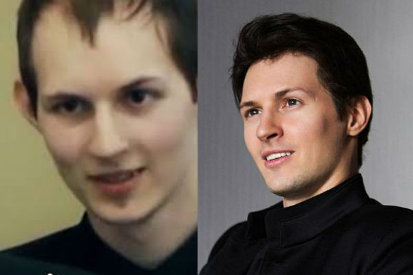 Как изменилась внешность Павла Дурова после пластики лица фото