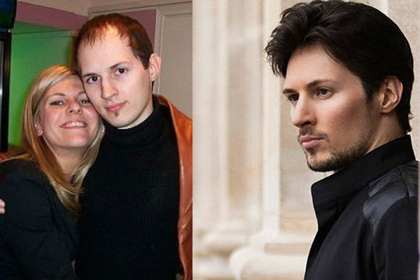 Как изменилась внешность Павла Дурова после пластики фото