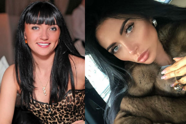 Светская львица и блогер Марина Майер до и после пластики лица, ринопластики и увеличения бюста фото