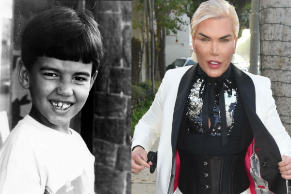 Живой Родриго Алвес до и после пластики лица фото