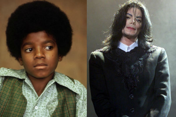 Майкл Джексон до и после пластики лица как менялся известный певец фото