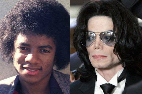 Майкл Джексон до и после пластики лица как менялся известный артист фото