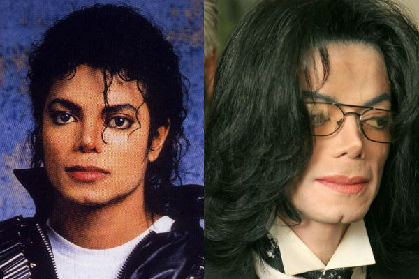 Майкл Джексон до и после пластики лица как со временем менялся известный артист фото