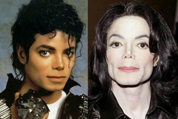 Майкл Джексон до и после пластики лица как со временем менялся известный певец фото