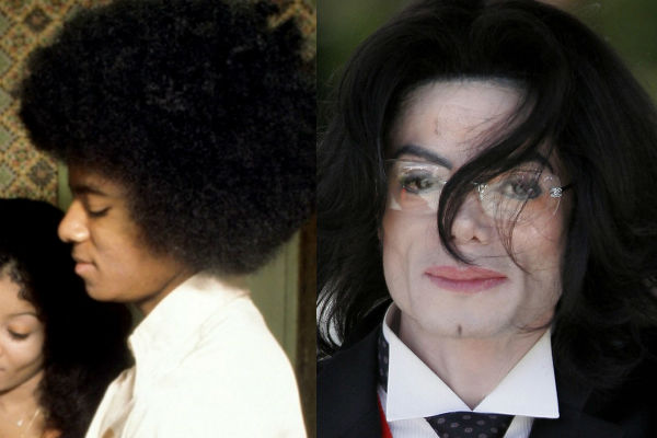 Певец Майкл Джексон до и после пластики лица фото