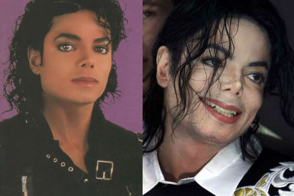 Певец Майкл Джексон до и после пластики фото
