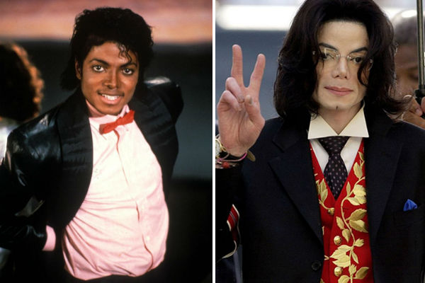 Майкл Джексон до и после пластики фото