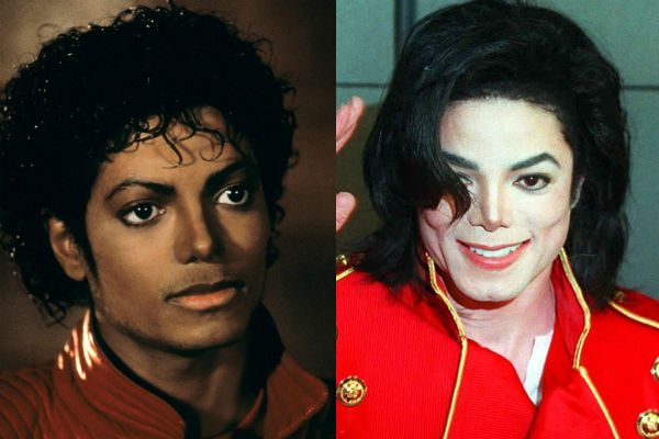 Майкл Джексон после многочисленной пластики фото