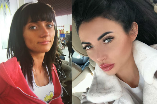 Марина Майер до и после пластических операций на лице фото