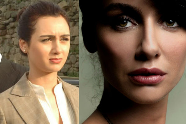 Известная турецкая актриса и модель Бирдже Акалай до и после ринопластики, пластики губ  и уколов красоты фото