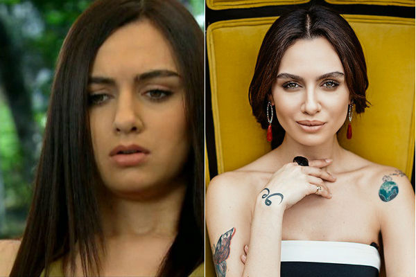 Известная турецкая актриса и модель Бирдже Акалай до и после ринопластики, пластики губ фото