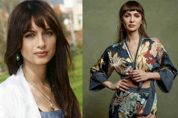 Известная турецкая актриса и модель Бирдже Акалай до и после пластики лица фото