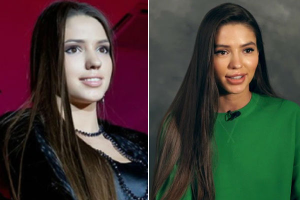 Модель Виктория Короткова до и после пластики губ и носа фото