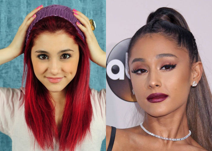 Популярная певица Ариана Гранде до и после пластики лица и удачного похудения фото