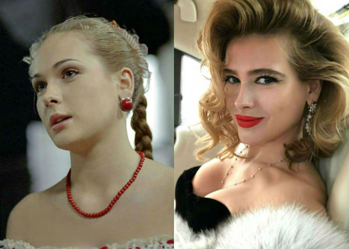 Анна Горшкова до и после пластики фото