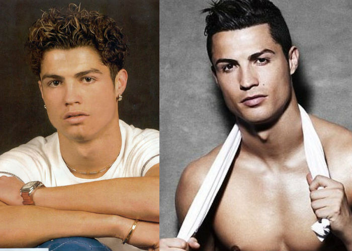 Известный португальский футболист Криштиану Роналду до и после пластики лица фото