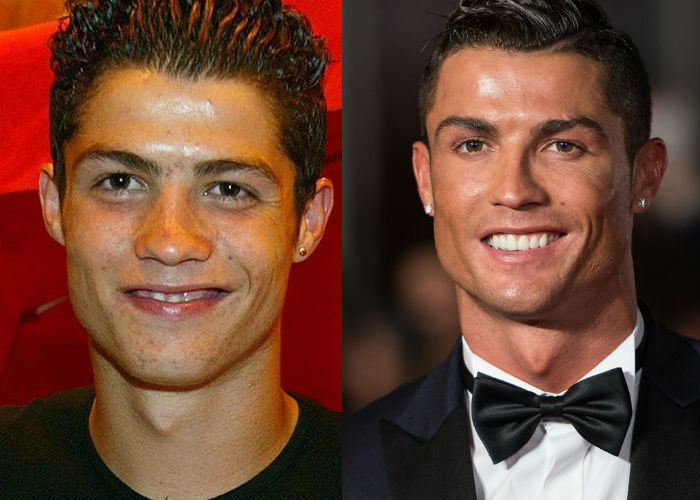 Известный португальский футболист Криштиану Роналду до и после пластики фото