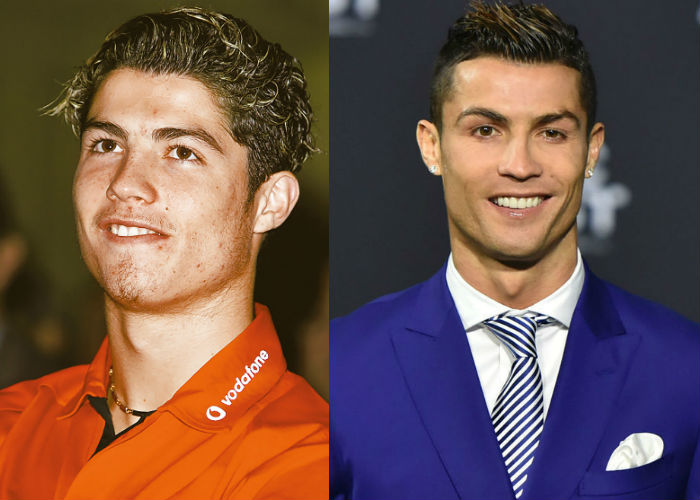 Известный футболист Криштиану Роналду до и после пластики фото