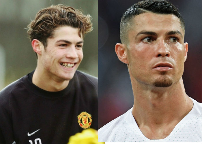 Португальский футболист Криштиану Роналду до и после пластики фото