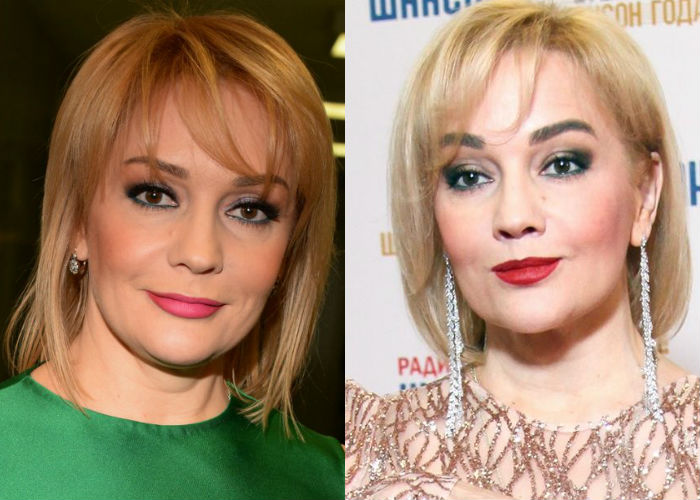 Популярная русская певица Татьяна Буланова до и после омолаживающей пластики лица фото