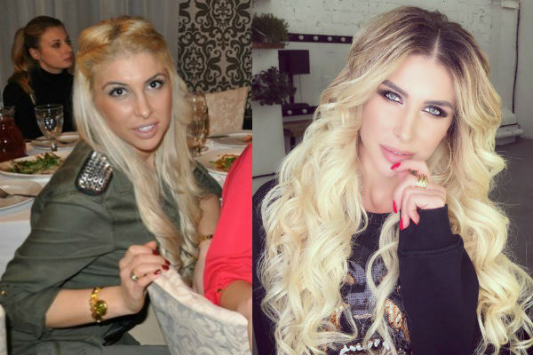 Жена футболиста Алина Хомич до и после пластики фото