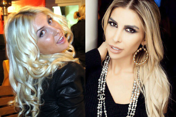 Алина Хомич до и после пластики лица фото
