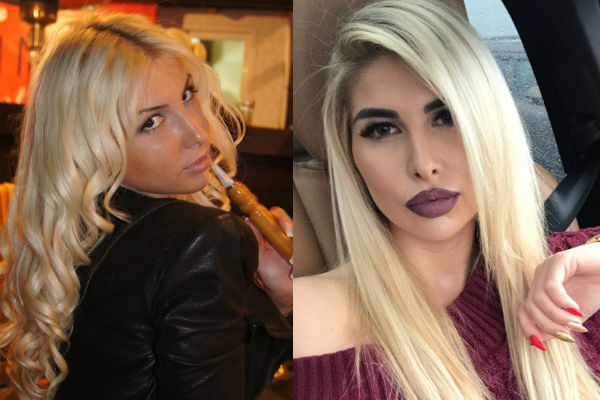 Алина Хомич до и после пластики губ фото