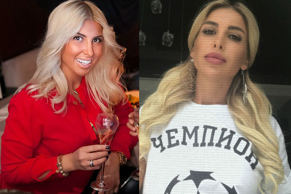 Алина Хомич до и после ринопластики фото