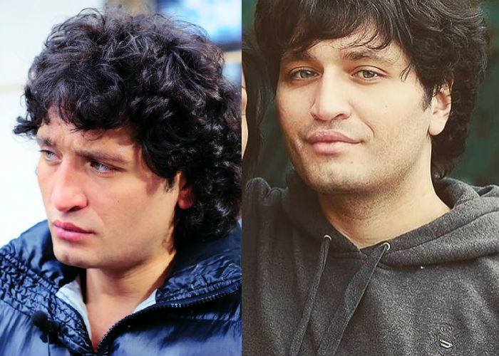 Бывший участник проекта "Дом-2" Рустам Солнцев до и после ринопластики, увеличения губ фото