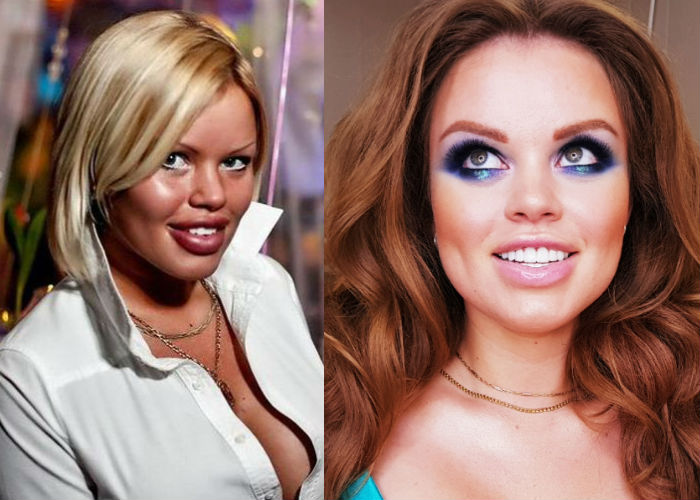 Известная эксцентричная модель и звезда инстаграма Олеся Малибу до и после пластики лица, увеличения груди и губ фото