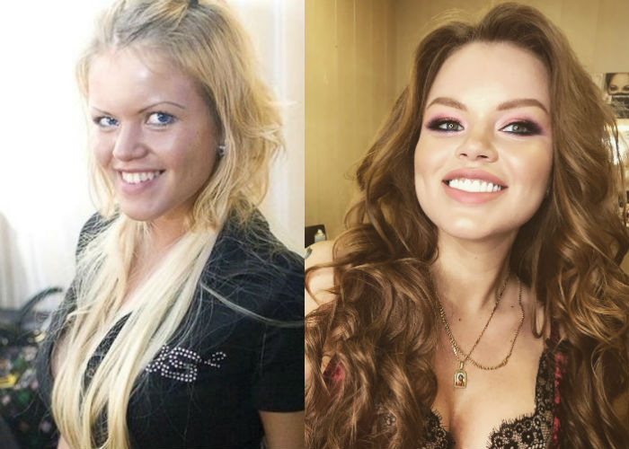 Известная эксцентричная модель и звезда инстаграма Олеся Малибу до и после пластики лица, увеличения груди фото