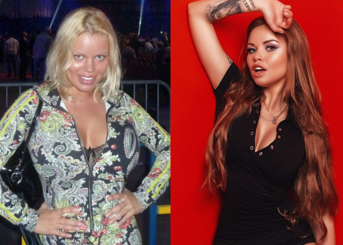 Известная модель и звезда инстаграма Олеся Малибу до и после пластики лица, увеличения груди и губ фото