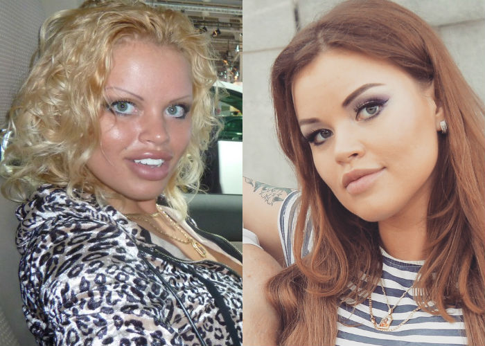 Эксцентричная модель и звезда инстаграма Олеся Малибу до и после пластики лица, увеличения груди и губ фото