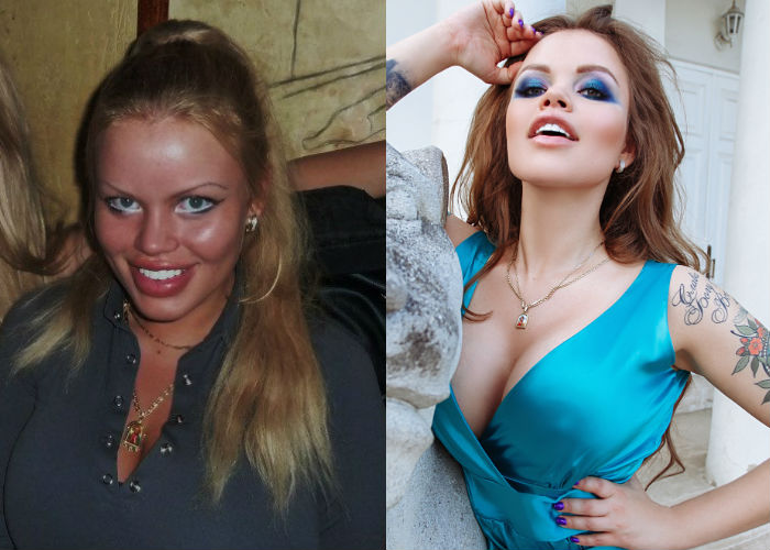 Звезда инстаграма Олеся Малибу до и после пластики лица, увеличения груди и губ фото