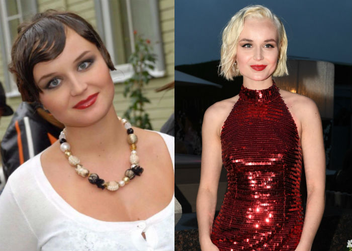 Известная певица красавица Полина Гагарина до и после удачной многочисленной пластики лица и похудения на 40 килограмм фото