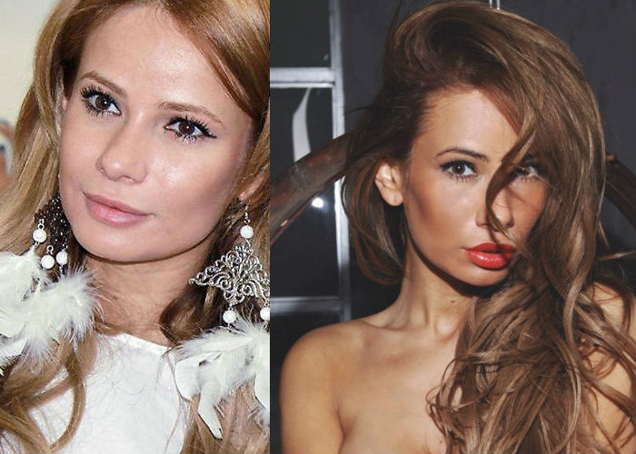 Известная русская селебрити, блогер и телеведущая Айза Анохина до и после пластики носа, губ фото